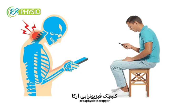 درمان عارضه سر به جلو با فیزیوتراپی (Forward Head Posture)