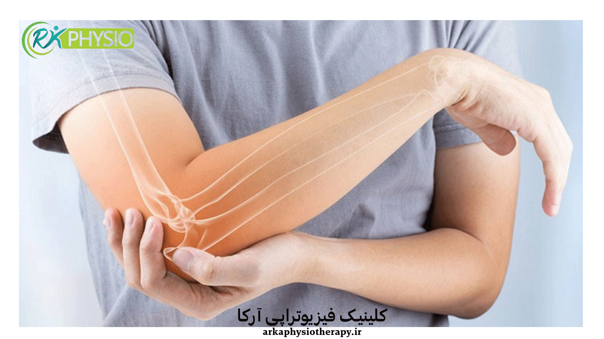 تنیس البو یا آرنج تنیس بازان چیست؟
