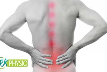 فیزیوتراپی اسپوندیلیت آنکیلوزان