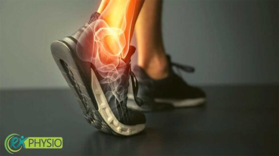فیزیوتراپی رگ به رگ شدن مچ پا