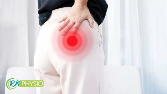 سندرم پیریفورمیس چیست؟ 