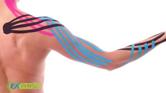 چسب کینزیوتیپینگ