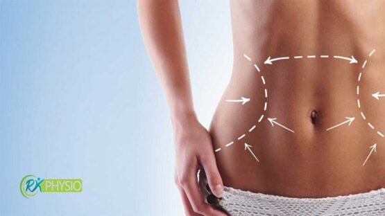 درمان دیاستاز شکمی با فیزیوتراپی
