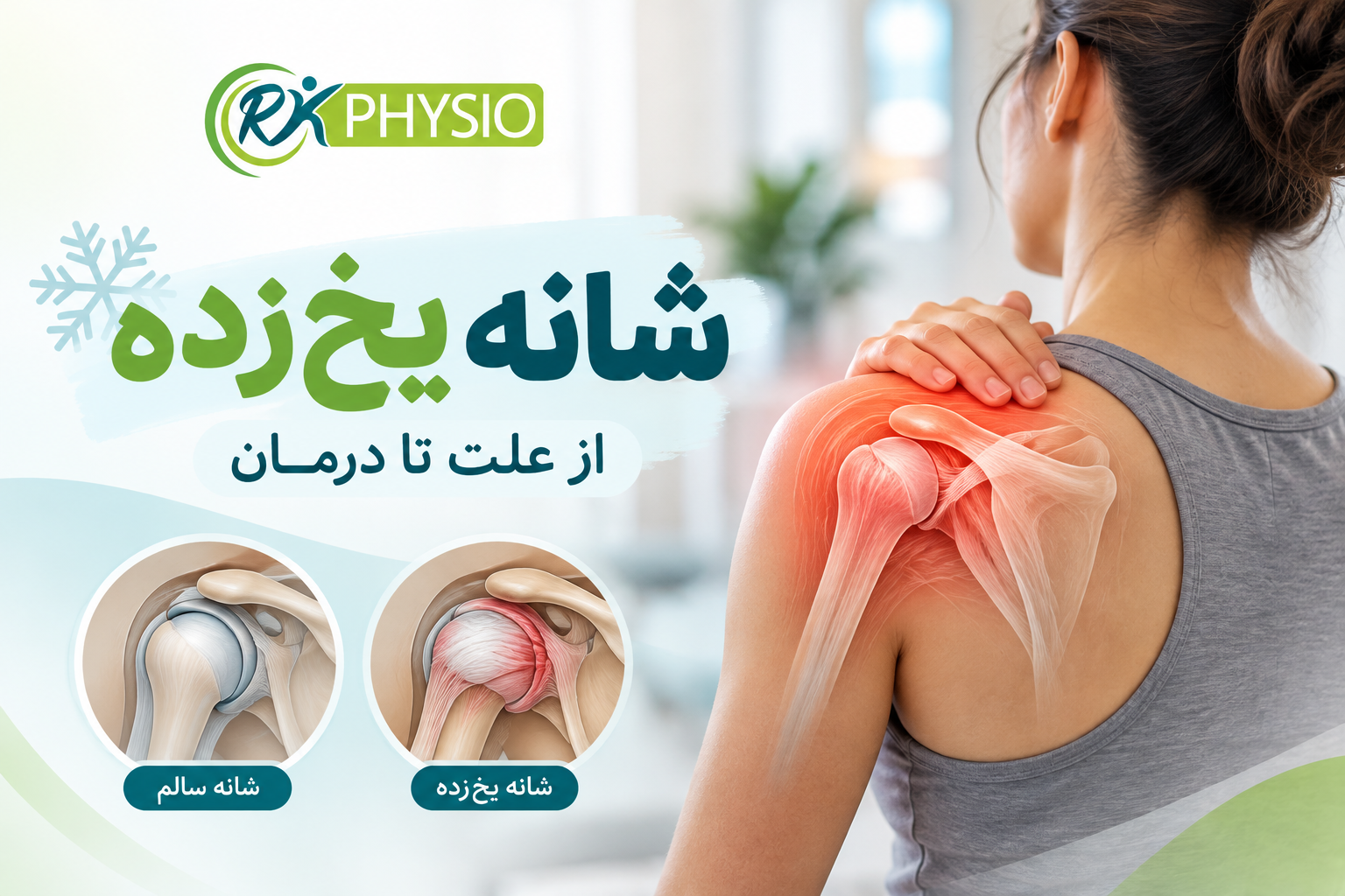 شانه یخ‌زده چیست؟ علائم، علت‌ها و روش‌های درمان